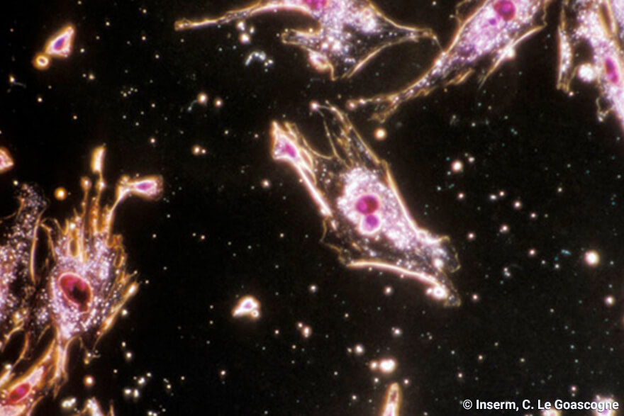 Le stress oxydatif et l'Endométriose - inserm